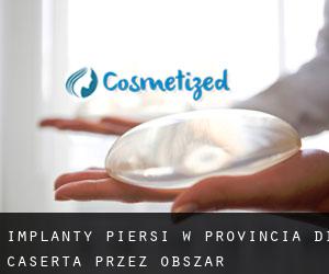 Implanty piersi w Provincia di Caserta przez obszar metropolitalny - strona 3