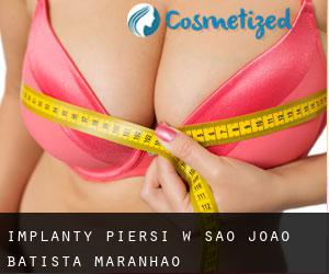Implanty piersi w São João Batista (Maranhão)