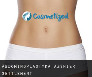 Abdominoplastyka Abshier Settlement