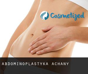 Abdominoplastyka Achany