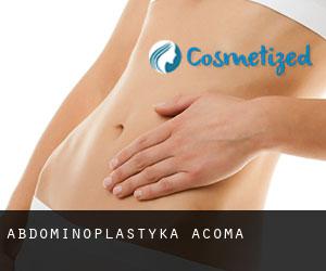 Abdominoplastyka Acoma