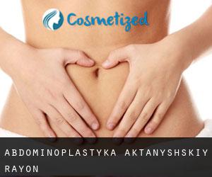 Abdominoplastyka Aktanyshskiy Rayon
