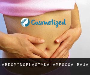 Abdominoplastyka Améscoa Baja