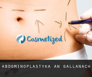 Abdominoplastyka An Gallanach