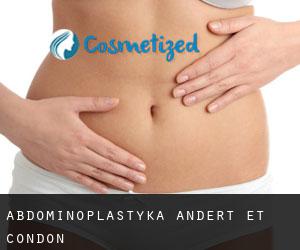 Abdominoplastyka Andert-et-Condon