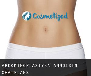 Abdominoplastyka Annoisin-Chatelans
