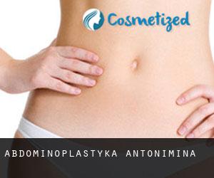 Abdominoplastyka Antonimina