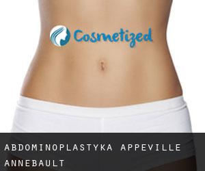 Abdominoplastyka Appeville-Annebault