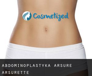 Abdominoplastyka Arsure-Arsurette