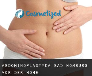Abdominoplastyka Bad Homburg vor der Höhe