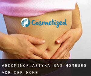 Abdominoplastyka Bad Homburg vor der Höhe