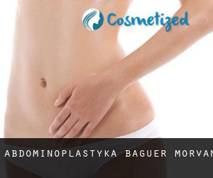 Abdominoplastyka Baguer-Morvan