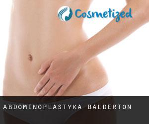 Abdominoplastyka Balderton