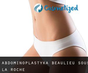Abdominoplastyka Beaulieu-sous-la-Roche