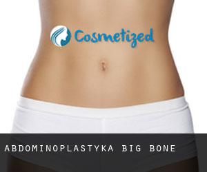 Abdominoplastyka Big Bone