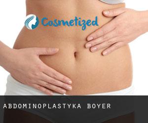 Abdominoplastyka Boyer