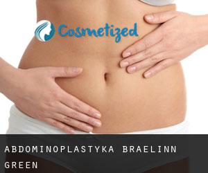 Abdominoplastyka Braelinn Green