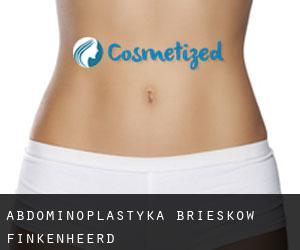 Abdominoplastyka Brieskow-Finkenheerd
