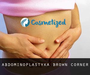 Abdominoplastyka Brown Corner