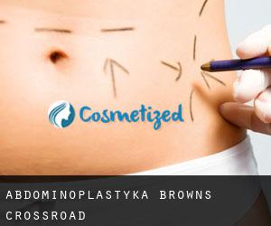 Abdominoplastyka Browns Crossroad