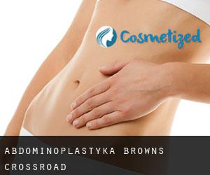 Abdominoplastyka Browns Crossroad