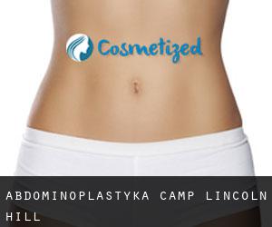Abdominoplastyka Camp Lincoln Hill
