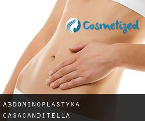 Abdominoplastyka Casacanditella