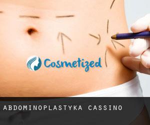 Abdominoplastyka Cassino