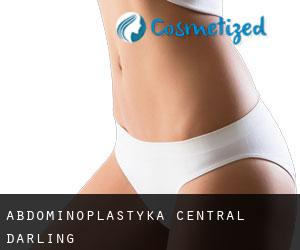 Abdominoplastyka Central Darling