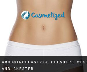 Abdominoplastyka Cheshire West and Chester