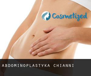 Abdominoplastyka Chianni