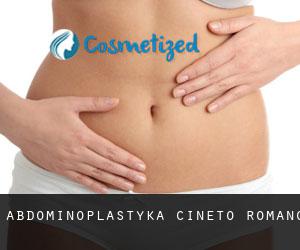 Abdominoplastyka Cineto Romano