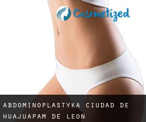 Abdominoplastyka Ciudad de Huajuapam de León