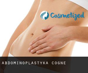 Abdominoplastyka Cogne