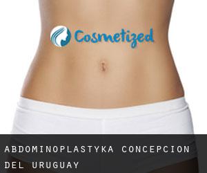 Abdominoplastyka Concepción del Uruguay