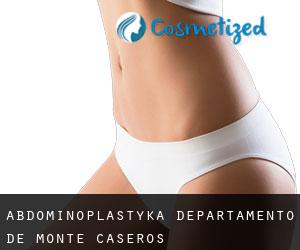Abdominoplastyka Departamento de Monte Caseros