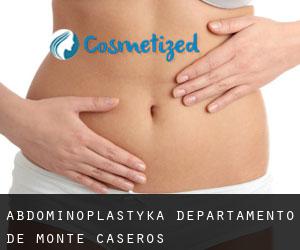 Abdominoplastyka Departamento de Monte Caseros