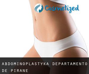 Abdominoplastyka Departamento de Pirané