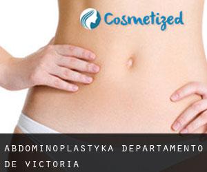 Abdominoplastyka Departamento de Victoria