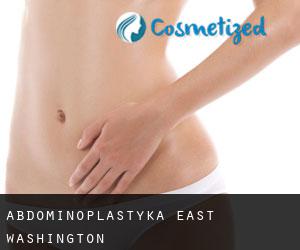 Abdominoplastyka East Washington