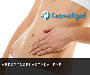 Abdominoplastyka Eye
