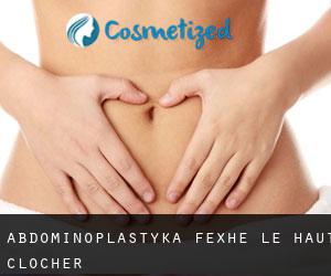 Abdominoplastyka Fexhe-le-Haut-Clocher