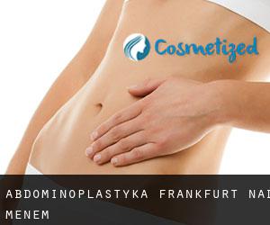 Abdominoplastyka Frankfurt nad Menem Abdominoplastyka Frankfurt nad Menem