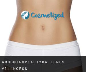 Abdominoplastyka Funes - Villnoess