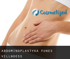 Abdominoplastyka Funes - Villnoess