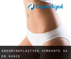 Abdominoplastyka Gemeente Aa en Hunze