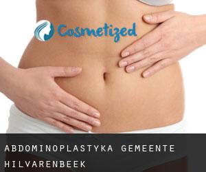 Abdominoplastyka Gemeente Hilvarenbeek