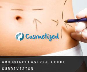 Abdominoplastyka Goode Subdivision