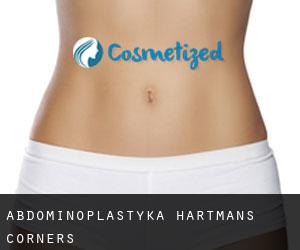 Abdominoplastyka Hartmans Corners