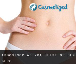 Abdominoplastyka Heist-op-den-Berg
